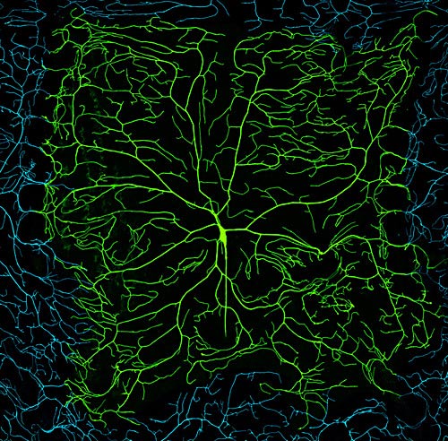 Drosophila dendritic arborization (da) neurons